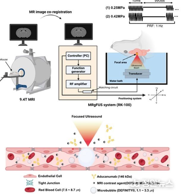 초음파 활용 치매 개선기술 발표
